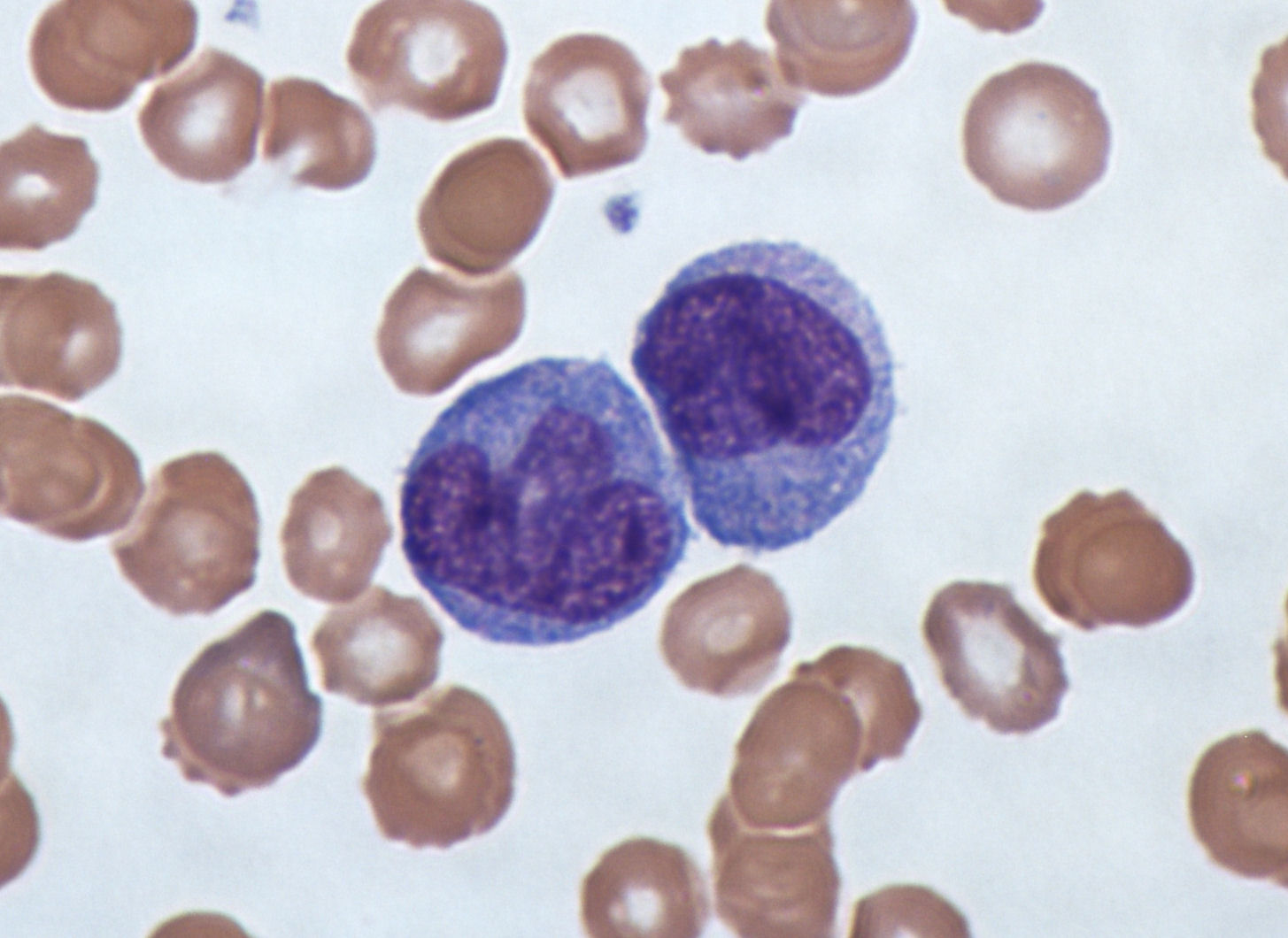 Monocyte, un type de globule blanc du système immunitaire, observé au microscope (coloration de Giemsa)