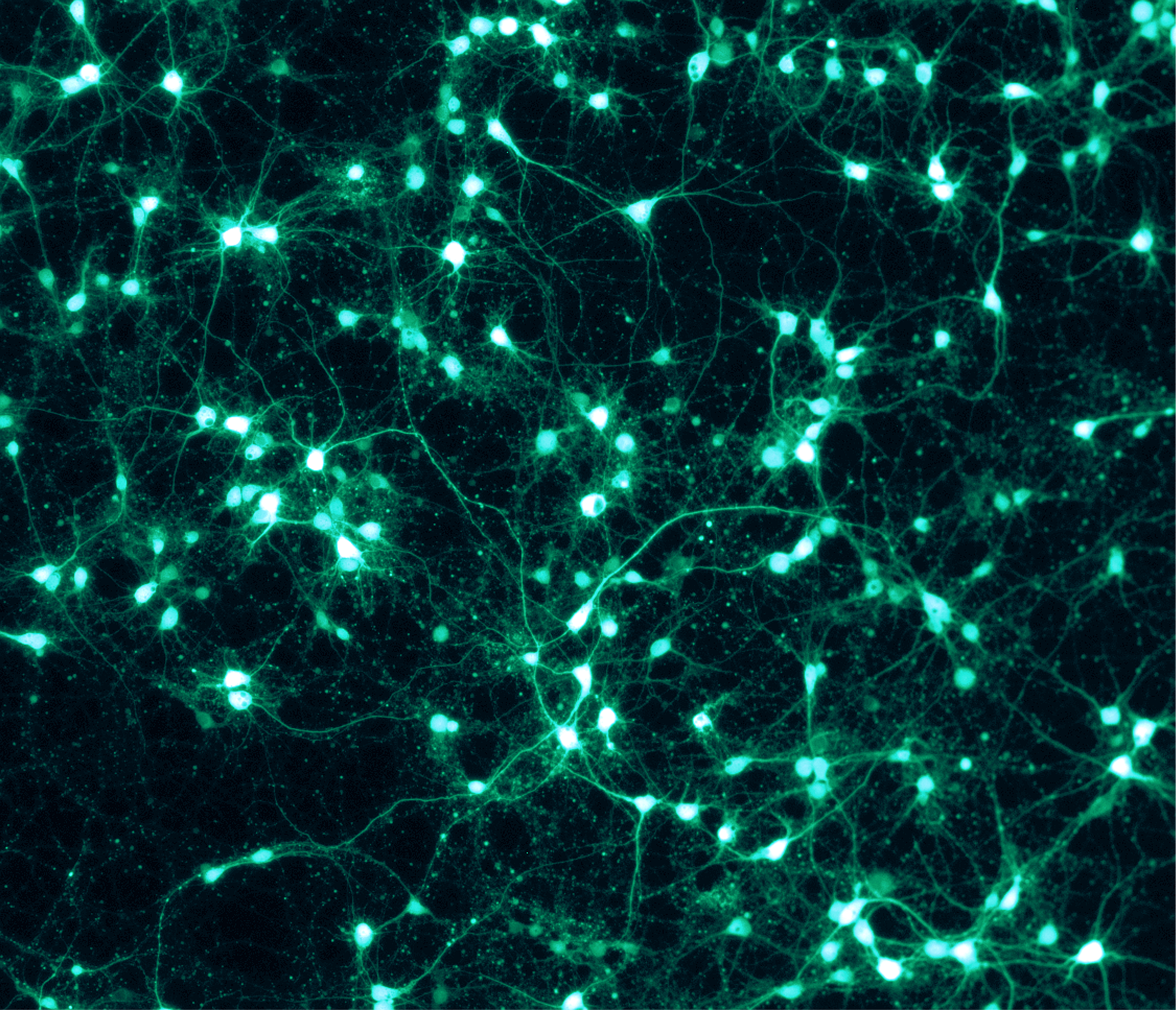 Neurones réels observés au microscope à fluorescence, avec leurs prolongements (axones et dendrites)